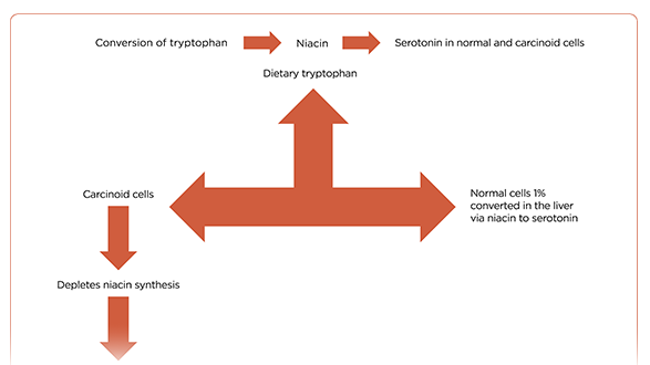 Carcinoid Heart Disease